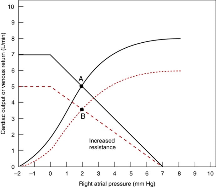 Diagram used in Cardiac Output — Master Answer