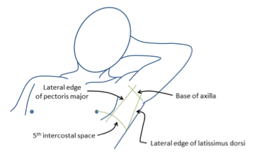 Diagram used in Procedure – ICC — Master Answer