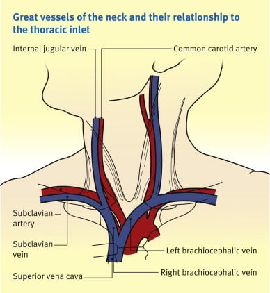 Harold Ellis, The great veins of the neck,Anaesthesia & Intensive Care Medicine