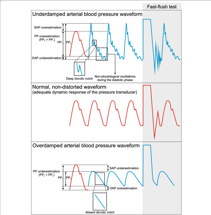 Diagram: Bedside Flush Test: