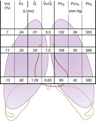 Diagram used in VQ – West’s — Master Answer