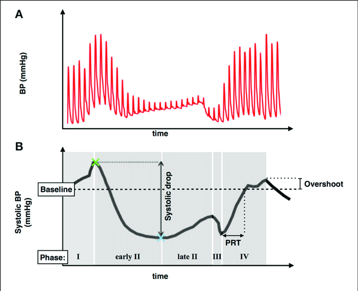 Diagram: Phase IV