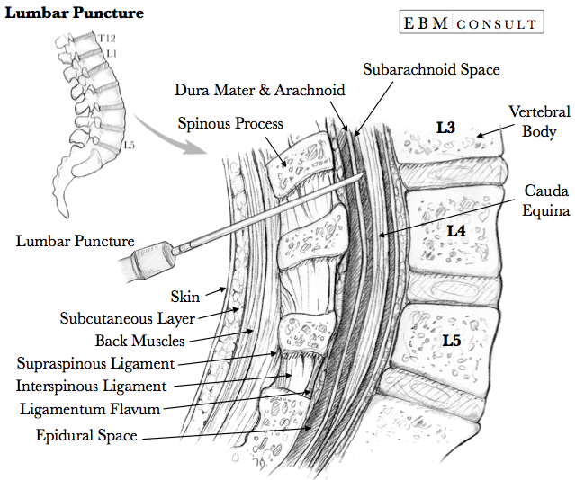 Diagram: Tissues and target for LP: