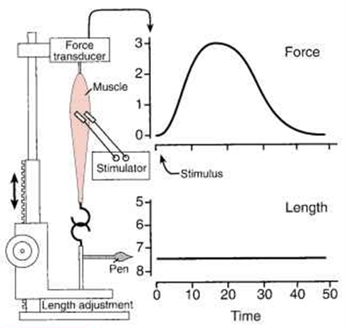 Diagram used in MSK – Tension — Master Answer