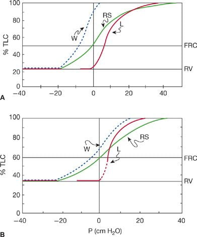 Diagram used in Applied Resp – Other Physiology — Master Answer