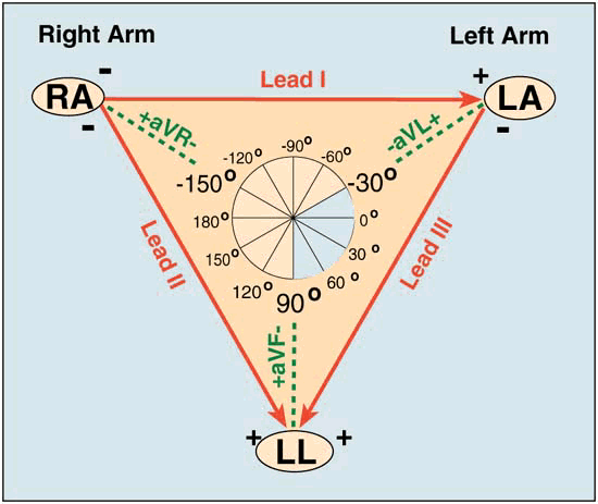 Diagram: ECG
