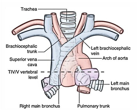 Diagram: Bronchi